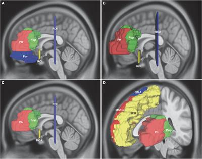 Association fiber tracts related to Broca’s area: A comparative study based on diffusion spectrum imaging and fiber dissection